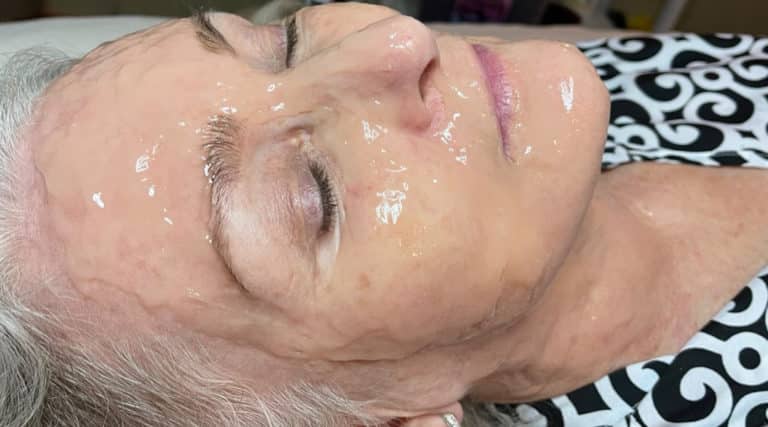 After Image: Facial - front