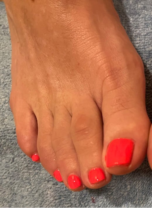 Before Image: Nails - front