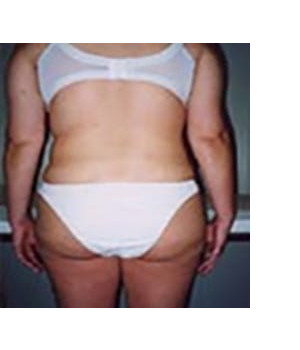 After Image