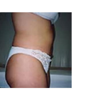 After Image