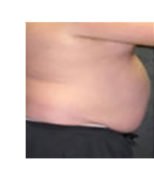Before Image: Transion – Case 4 - other