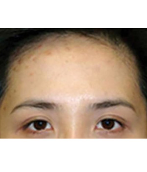 After Image